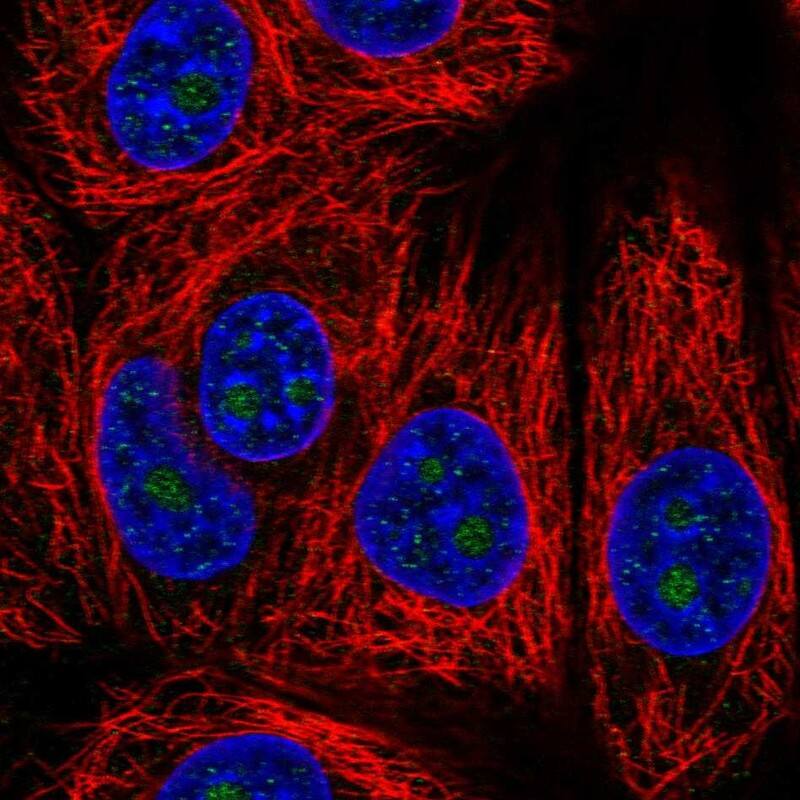 Staining of human cell line MCF7 shows localization to nucleoli.