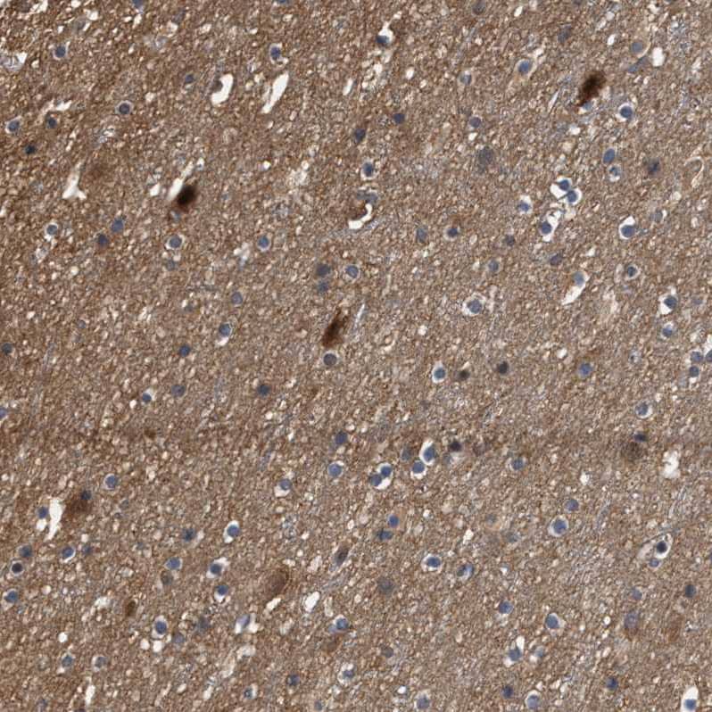 Staining of human cerebral cortex shows strong nuclear positivity in subset of neurons.