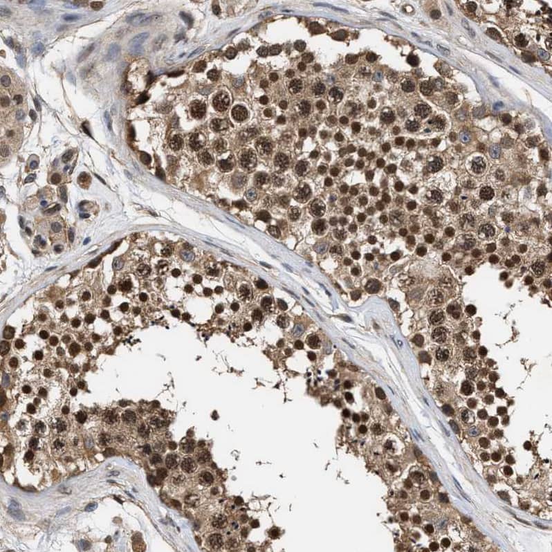 Staining of human testis shows strong nuclear positivity in cells in seminiferous ducts.