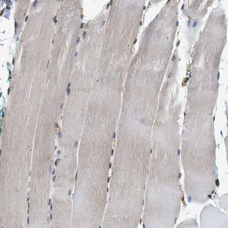 Staining of human skeletal muscle shows weak cytoplasmic positivity in myocytes.