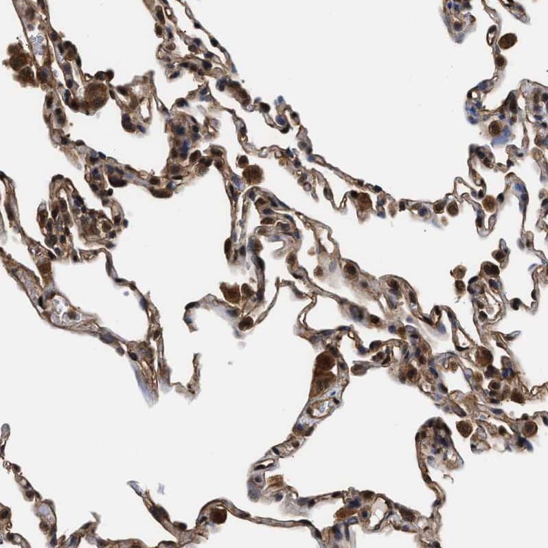 Staining of human lung shows strong nuclear positivity in macrophages.
