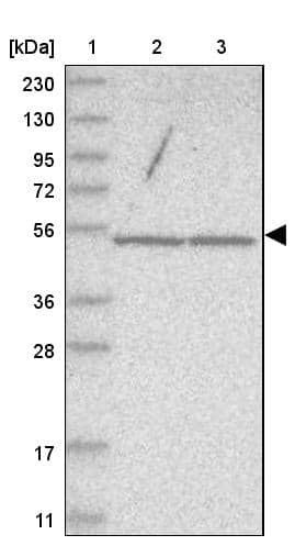 Lane 1: Marker [kDa] 230, 130, 95, 72, 56, 36, 28, 17, 11Lane 2: Human cell line RT-4Lane 3: Human cell line U-251MG sp