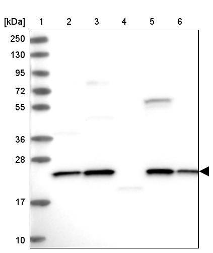 Western Blot NPVF Antibody - BSA Free