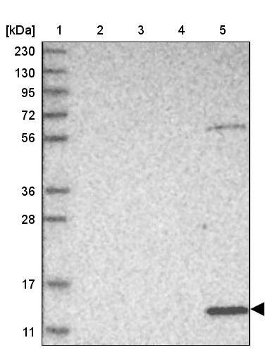 Lane 1: Marker [kDa] 230, 130, 95, 72, 56, 36, 28, 17, 11Lane 2: Human cell line RT-4Lane 3: Human cell line U-251MG spLane 4: Human plasma (IgG/HSA depleted)Lane 5: Human liver tissue