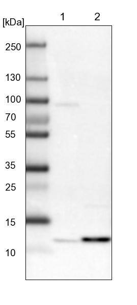 Lane 1: Mouse liver tissue lysateLane 2: Rat liver tissue lysate