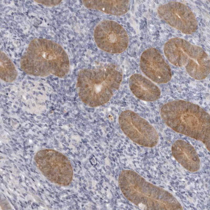 Staining of human corpus, uterine shows moderate cytoplasmic positivity in glandular cells.