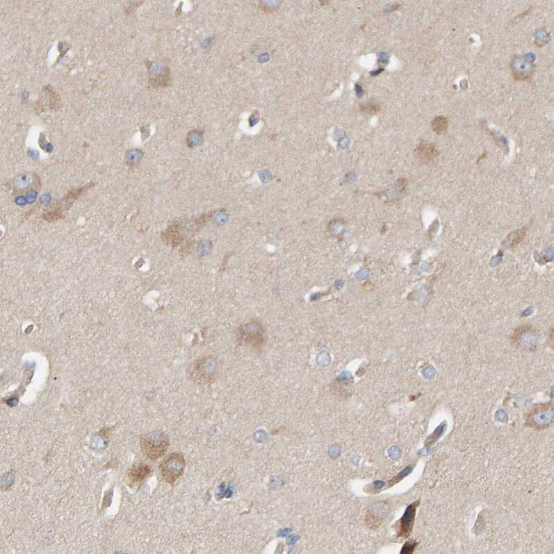 Staining of human cerebral cortex shows weak cytoplasmic positivity in neurons.