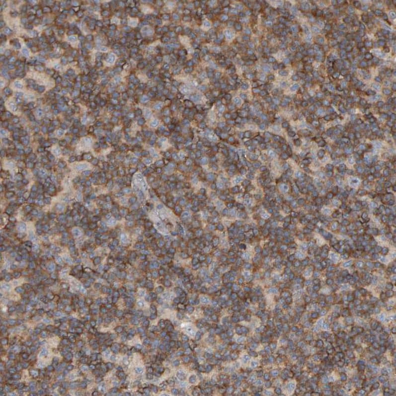 Staining of human lymph node shows moderate cytoplasmic positivity in non-germinal center cells.