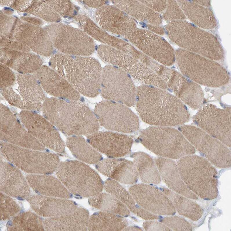 Staining of human skeletal muscle shows moderate cytoplasmic positivity in myocytes.