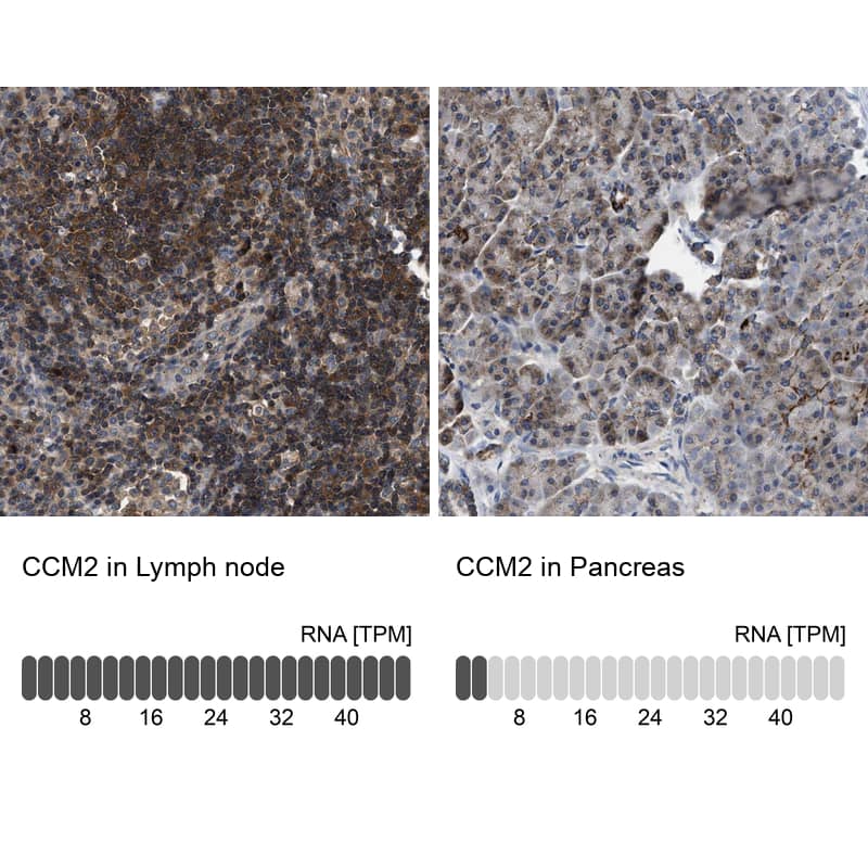 <b>Orthogonal Strategies Validation. </b>Analysis in human lymph node and pancreas tissues.