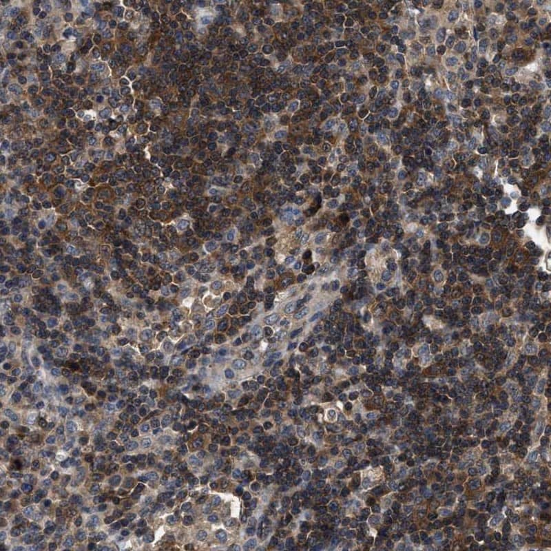 Staining of human lymph node shows high expression.