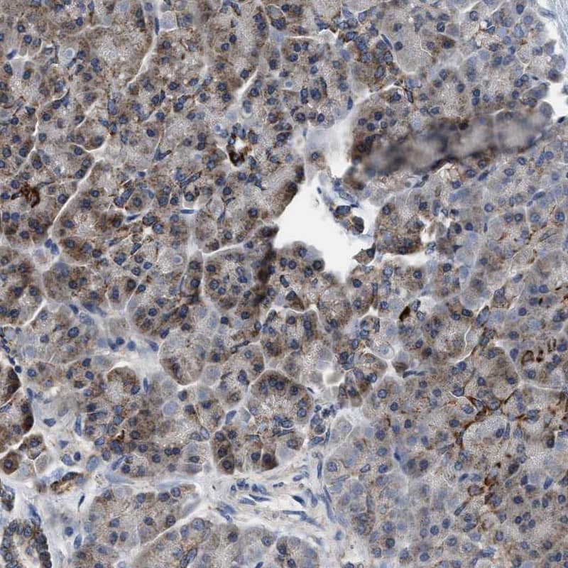 Staining of human pancreas shows low expression as expected.