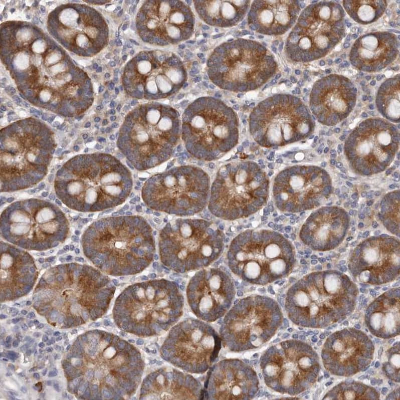 Staining of human duodenum shows moderate cytoplasmic positivity in glandular cells.