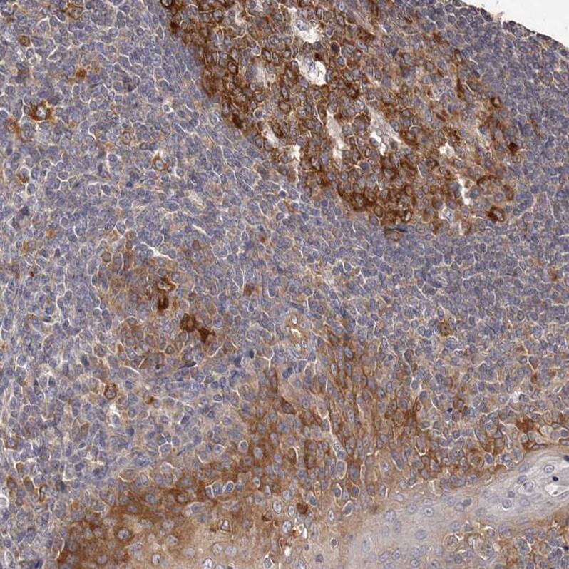 Staining of human tonsil shows moderate cytoplasmic positivity in germinal and non-germinal center cells and squamous epithelial cells.