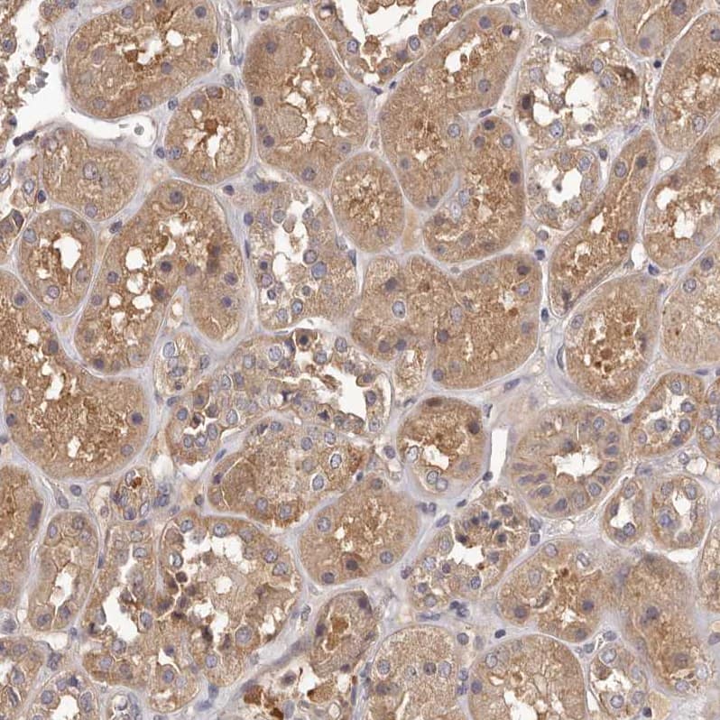 Staining of human kidney shows moderate cytoplasmic positivity in cells in tubules.