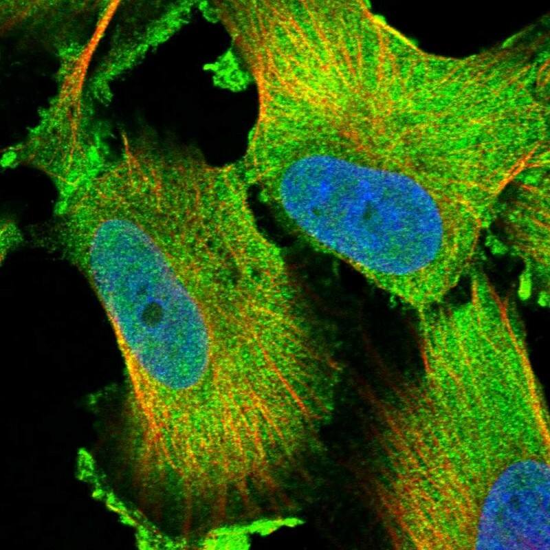 Staining of human cell line U-251 MG shows localization to nucleoplasm & cytosol.