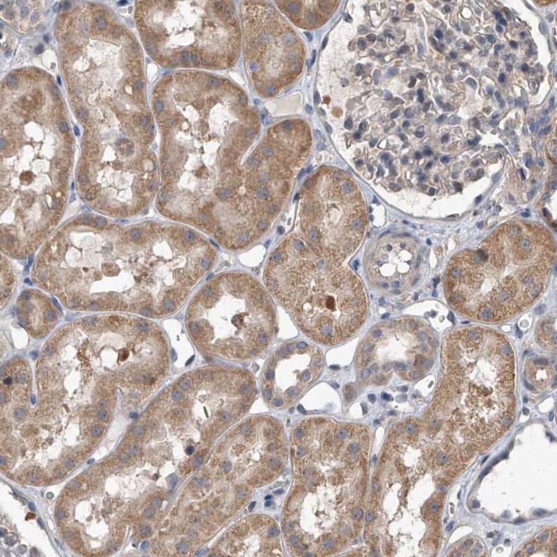 Immunohistochemistry-Paraffin LTV1 Antibody - BSA Free