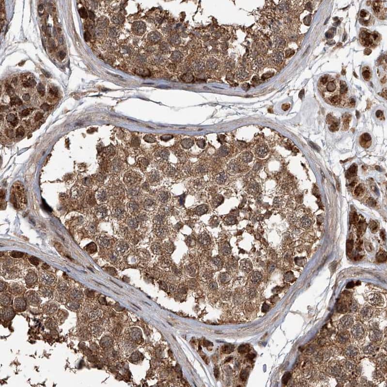 Immunohistochemistry-Paraffin LTV1 Antibody - BSA Free