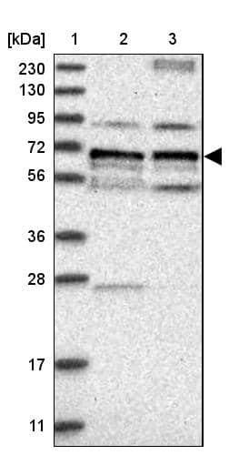 Lane 1: Marker [kDa] 230, 130, 95, 72, 56, 36, 28, 17, 11Lane 2: Human cell line RT-4Lane 3: Human cell line U-251MG sp