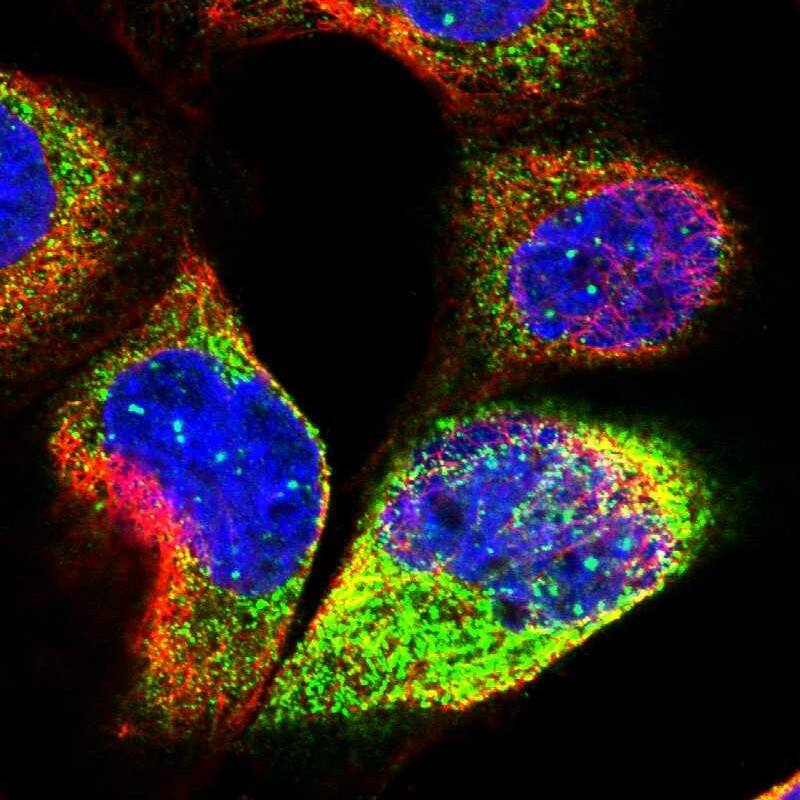Staining of human cell line A-431 shows localization to nuclear bodies & cytosol.