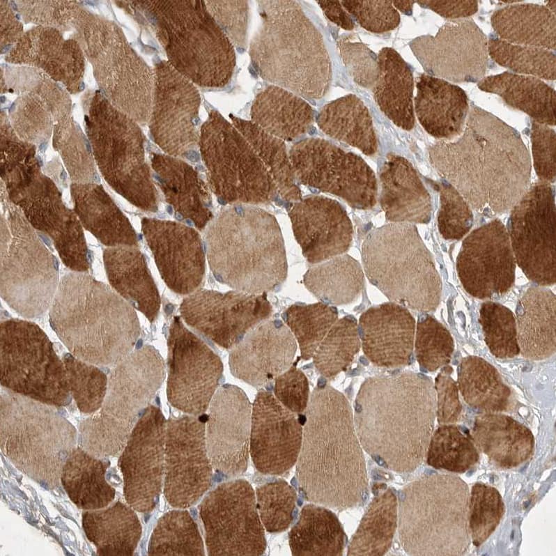 Staining of human skeletal muscle shows strong cytoplasmic positivity in myocytes.