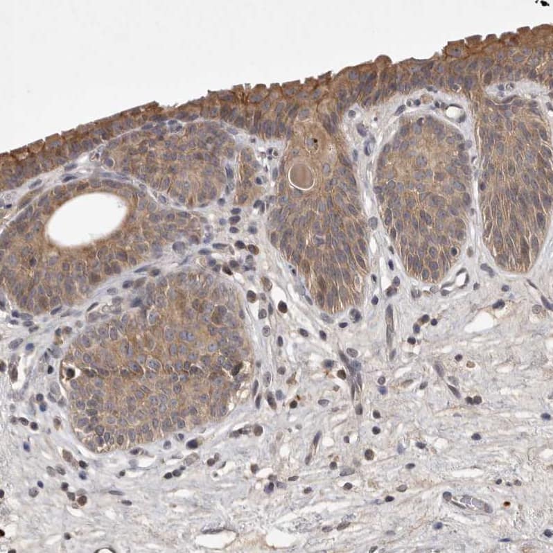 Staining of human urinary bladder shows weak cytoplasmic positivity in urothelial cells.