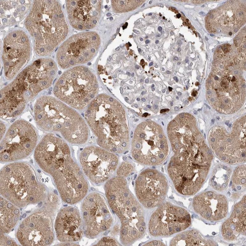 Staining of human kidney shows weak cytoplasmic positivity in cells in tubules.