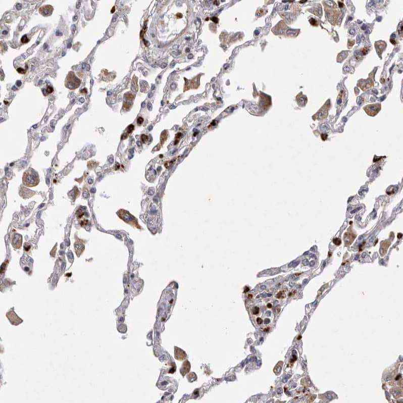 Staining of human lung shows moderate cytoplasmic positivity in macrophages.