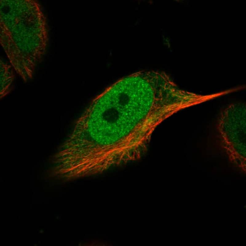 Staining of human cell line U-251 MG shows localization to nucleoplasm & cytosol.