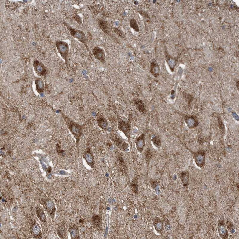 Staining of human hippocampus shows strong cytoplasmic positivity in neuronal cells.