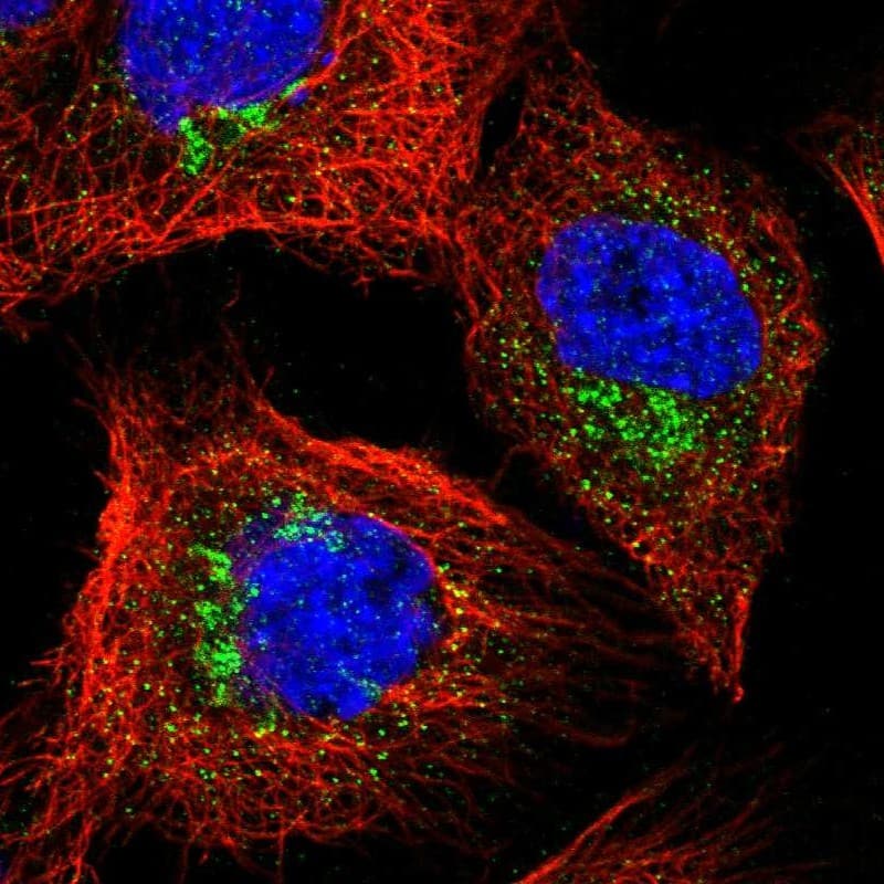 Staining of human cell line A-431 shows localization to the Golgi apparatus & vesicles.