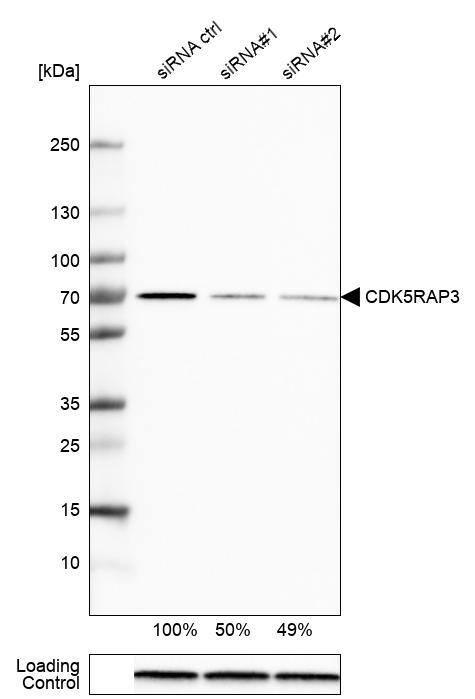 <b>Genetic Strategies Validation. </b>Analysis in MCF-7 cells transfected with control siRNA, target specific siRNA probe #1 and #2, using Anti-CDK5RAP3 antibody. Remaining relative intensity is presented. Loading control: Anti-GAPDH.