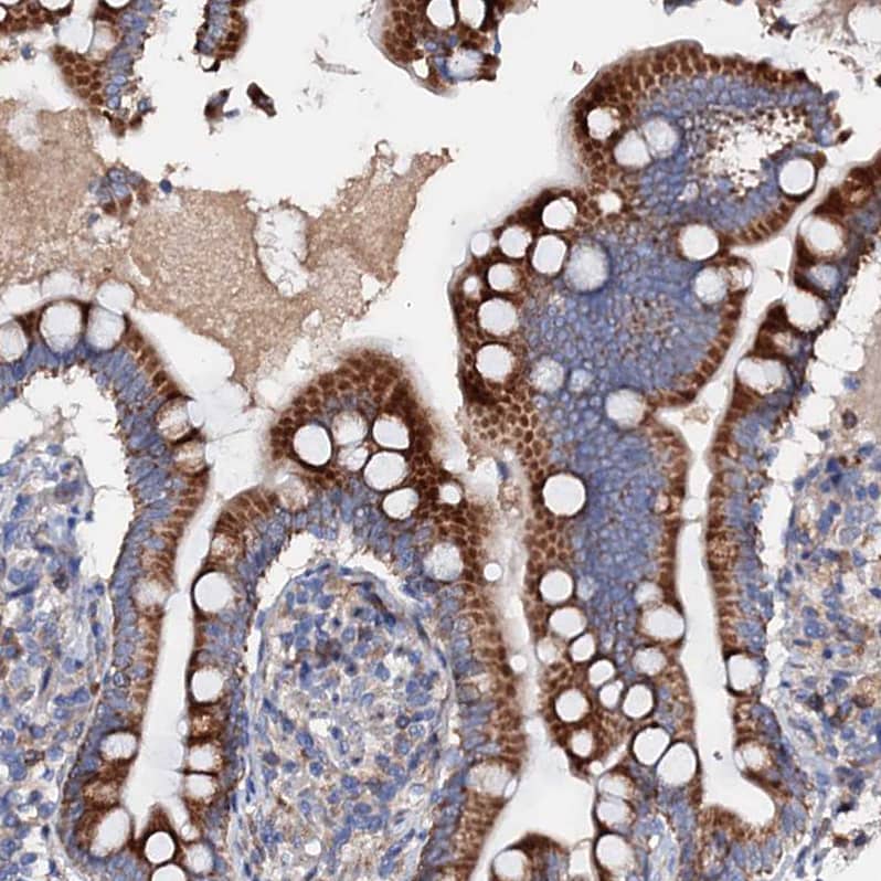 Immunohistochemistry-Paraffin SLC10A7 Antibody - BSA Free