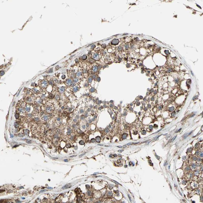 Immunohistochemistry-Paraffin MRPS22 Antibody - BSA Free