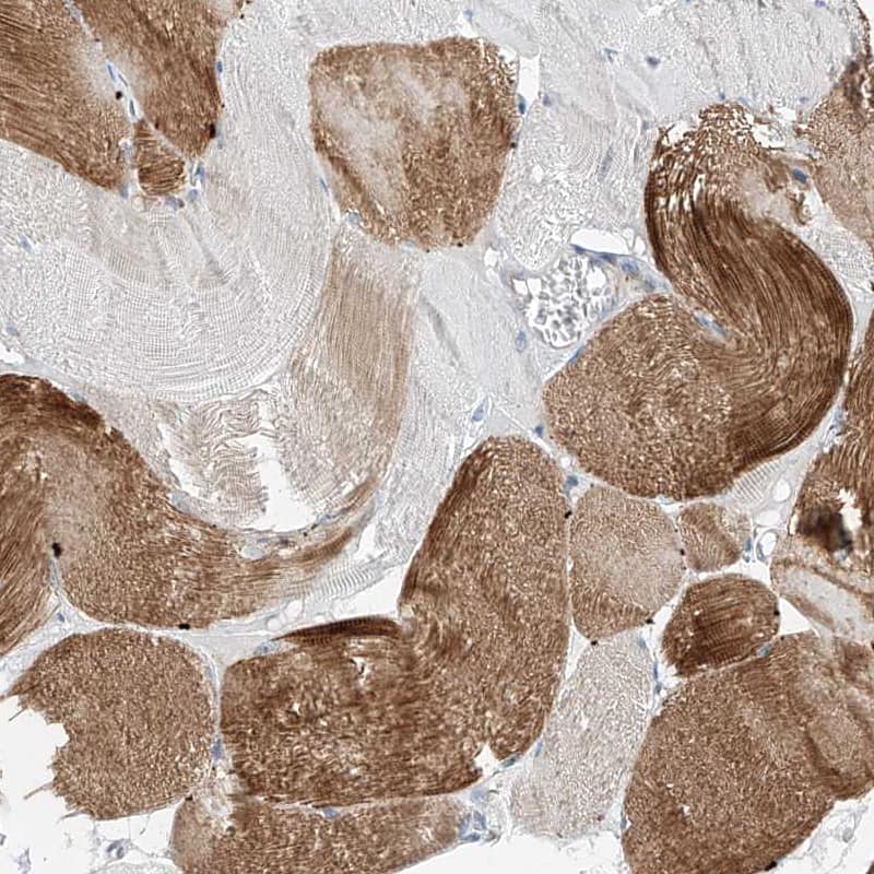 Staining of human skeletal muscle shows weak cytoplasmic positivity in myocytes.