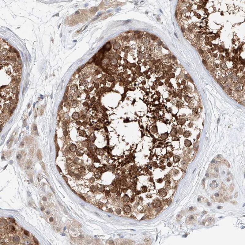 Staining of human testis shows strong cytoplasmic positivity in cells in seminiferous ducts.