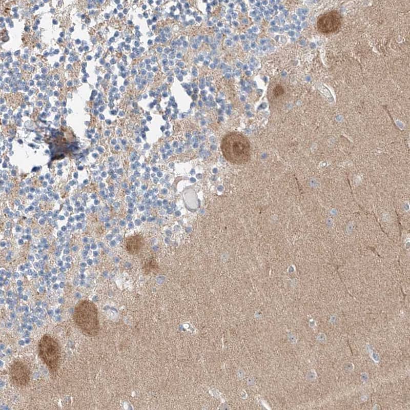 Staining of human cerebellum shows moderate cytoplasmic positivity in Purkinje cells.