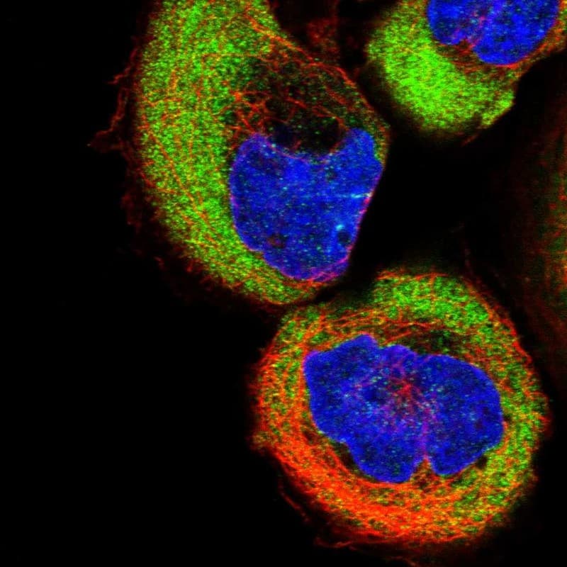 Staining of human cell line A-431 shows localization to cytosol.