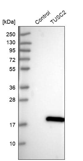 Analysis in control (vector only transfected HEK293T lysate) and TUSC2 over-expression lysate (Co-expressed with a C-terminal myc-DDK tag (~3.1 kDa) in mammalian HEK293T cells).