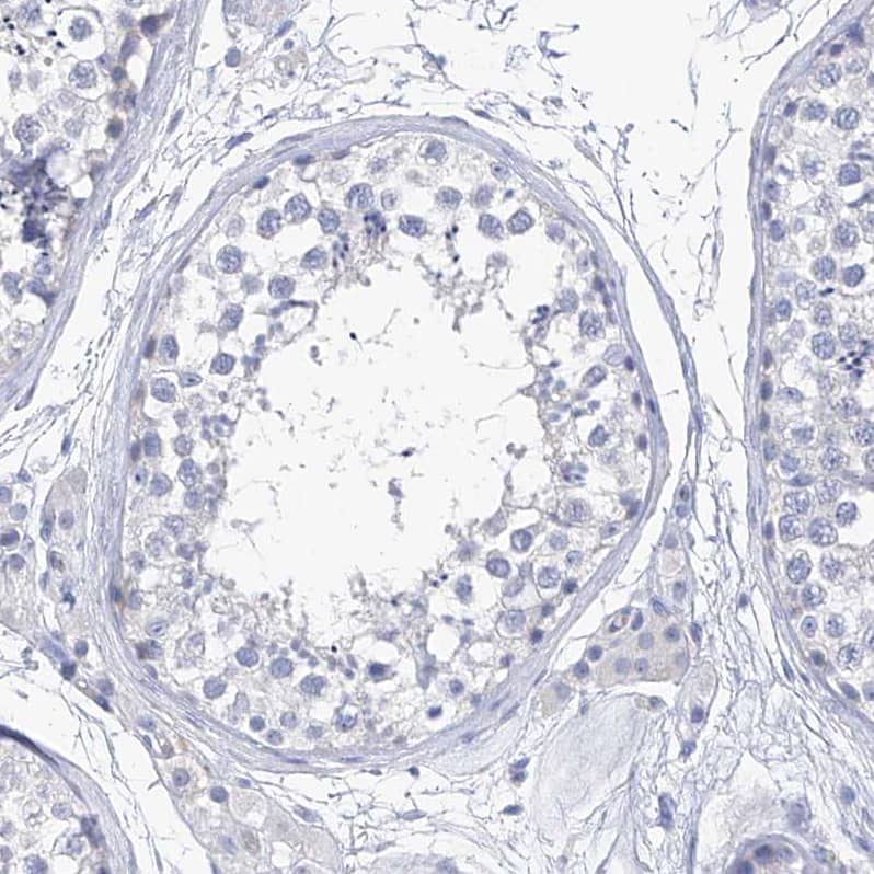 Staining of human testis shows no positivity in cells in seminiferous ducts as expected.