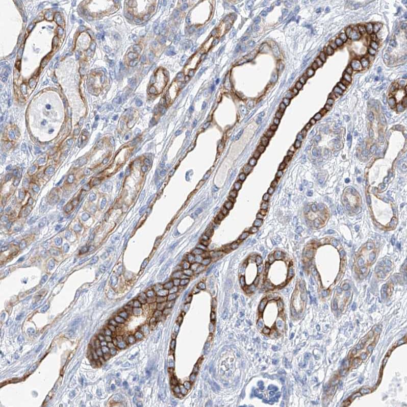 Staining of human kidney shows strong membranous positivity in subset of  cells in tubules.