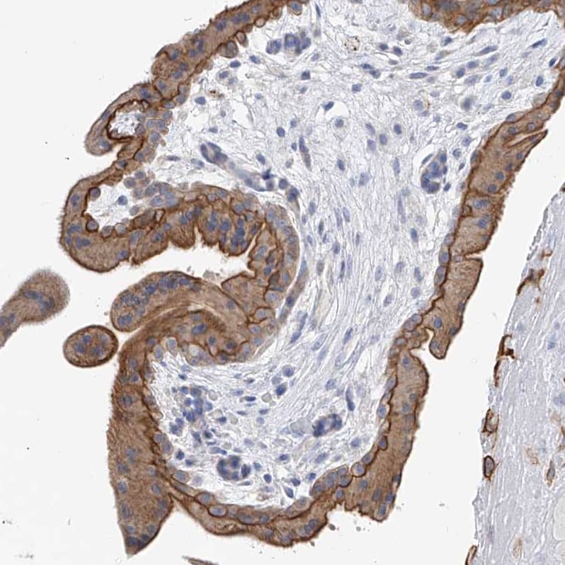 Staining of human placenta shows strong membranous and cytoplasmic positivity in trophoblastic cells.