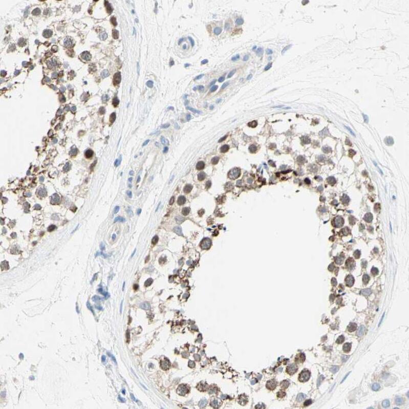 Staining of human testis shows strong cytoplasmic positivity in cells in seminiferous ducts.