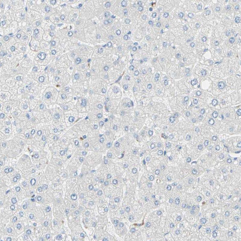 Staining of human liver shows no positivity in hepatocytes as expected.