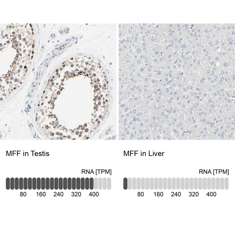 Immunohistochemistry-Paraffin MFF Antibody - BSA Free