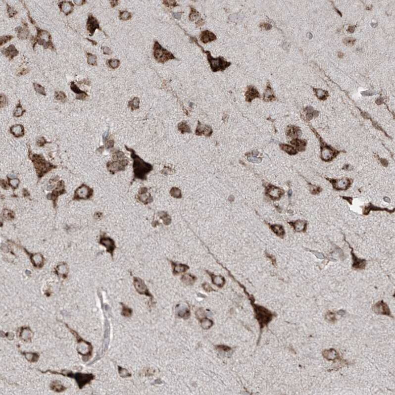 Immunohistochemistry-Paraffin ERLEC1 Antibody - BSA Free
