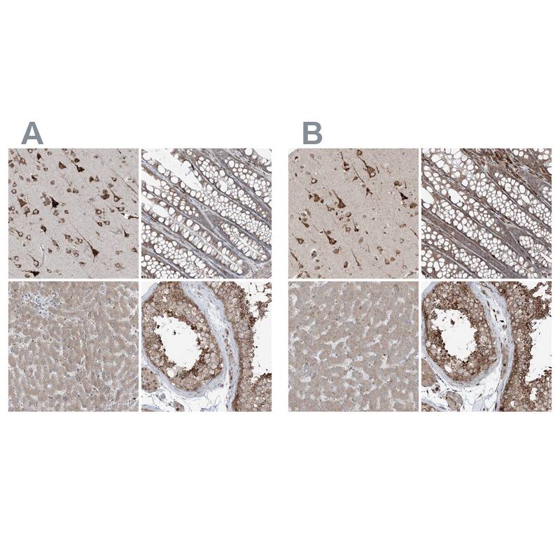 Immunohistochemistry-Paraffin ERLEC1 Antibody - BSA Free