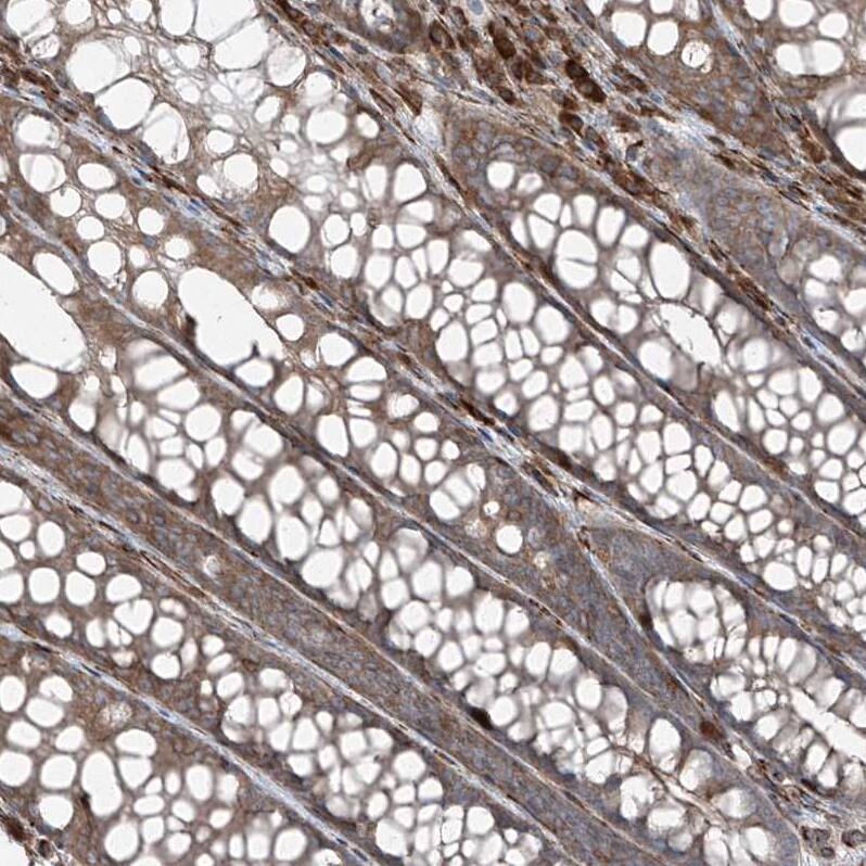 Immunohistochemistry-Paraffin ERLEC1 Antibody - BSA Free