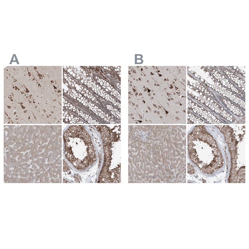 Immunohistochemistry-Paraffin ERLEC1 Antibody - BSA Free