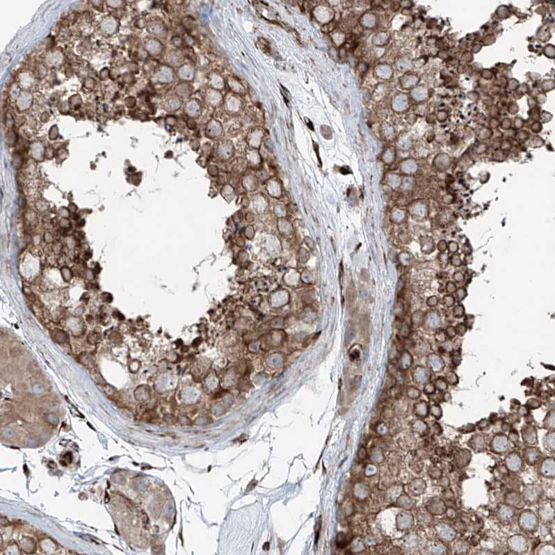 Immunohistochemistry-Paraffin ERLEC1 Antibody - BSA Free